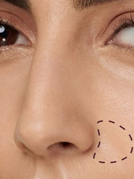 Area where redness might appear